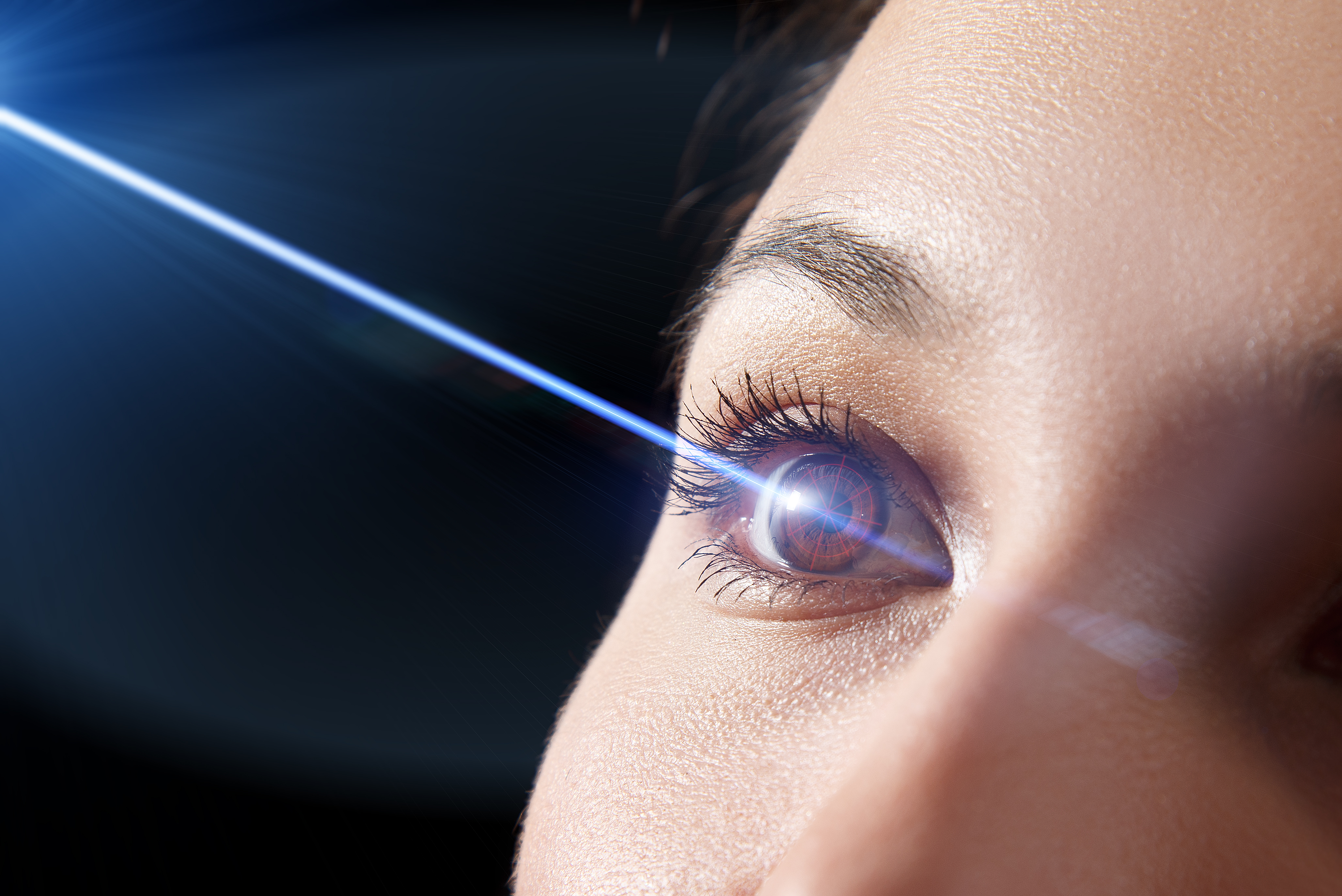 Лазерная коррекция зрения 2024. Коррекция зрения лазером. Лазерная коррекция зрени. Лазерная операция на глаза.
